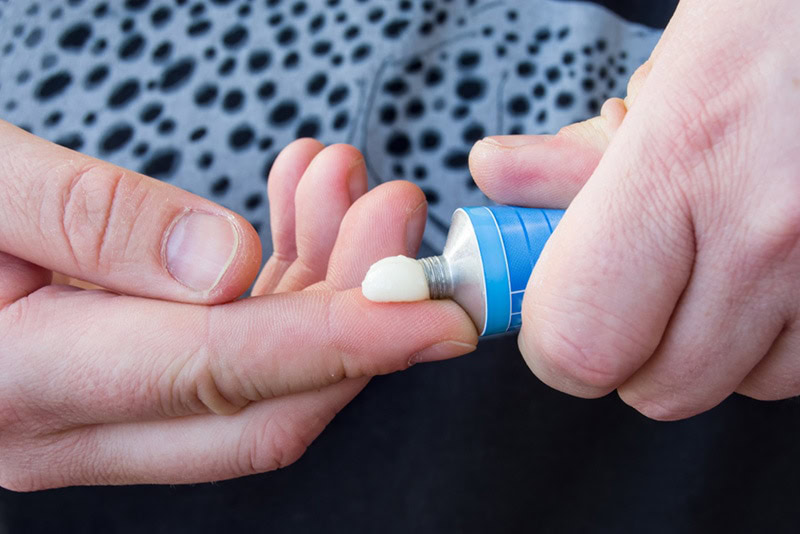 psoriasis ointment